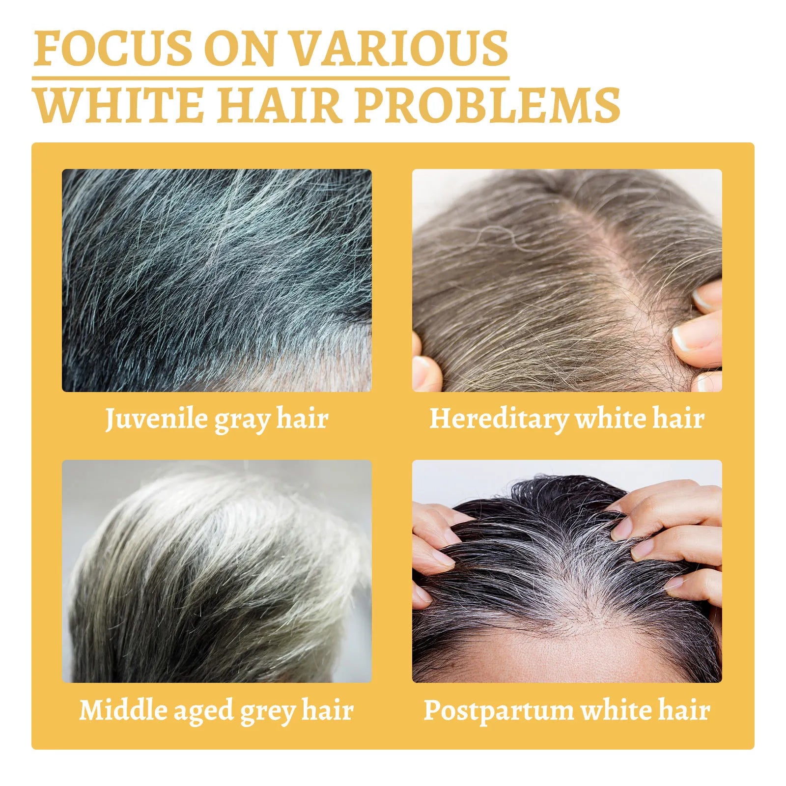 GrayRestore Serum™  Gray White Hair Treatment Serum Gray White Hair Treatment